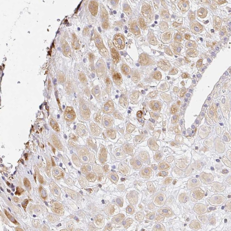 Immunohistochemistry (Formalin/PFA-fixed paraffin-embedded sections) - Anti-LH1 antibody (AB262947), expandable thumbnail