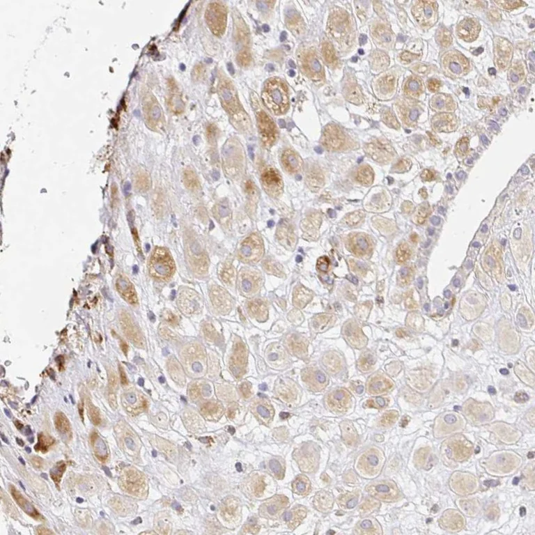 Immunohistochemistry (Formalin/PFA-fixed paraffin-embedded sections) - Anti-LH1 antibody (AB262947)