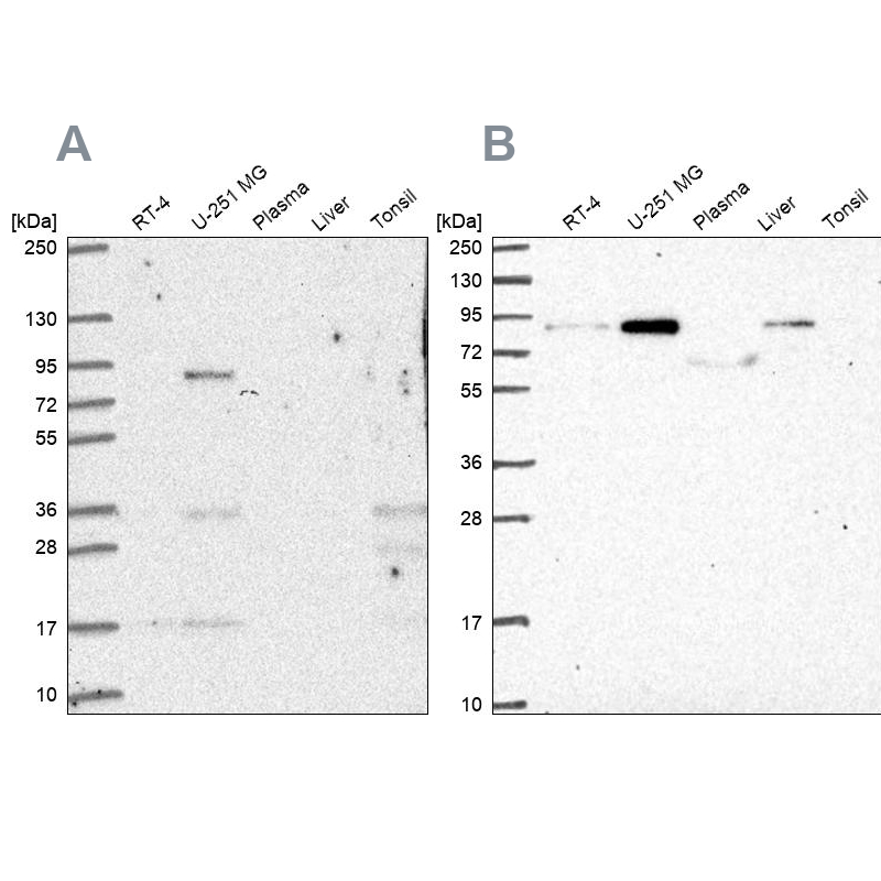 Western blot - Anti-LH1 antibody (AB262947), expandable thumbnail
