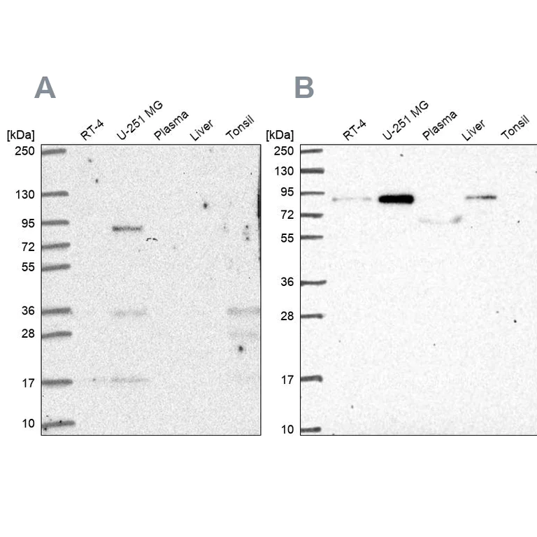 Western blot - Anti-LH1 antibody (AB262947)