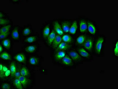 Immunocytochemistry/ Immunofluorescence - Anti-LHFPL5 antibody (AB234809)