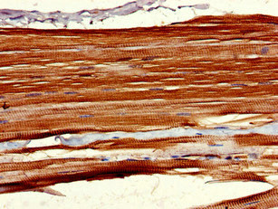 Immunohistochemistry (Formalin/PFA-fixed paraffin-embedded sections) - Anti-LHFPL5 antibody (AB234809)