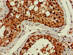 Immunohistochemistry (Formalin/PFA-fixed paraffin-embedded sections) - Anti-LHFPL5 antibody (AB234809)