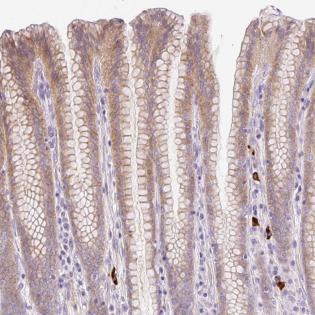 Immunohistochemistry (Formalin/PFA-fixed paraffin-embedded sections) - Anti-LHFPL5 antibody - C-terminal (AB185533), expandable thumbnail