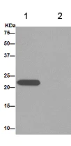 Immunoprecipitation - Anti-LHFPL5 antibody [EPR16285] - BSA and Azide free (AB232650)