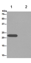 Immunoprecipitation - Anti-LHFPL5 antibody [EPR16285] - C-terminal (AB192242), expandable thumbnail