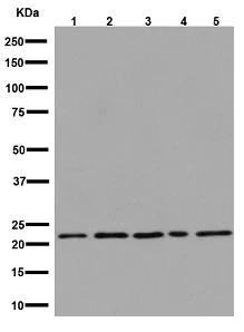 Western blot - Anti-LHFPL5 antibody [EPR16285] - C-terminal (AB192242)