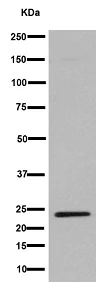 Western blot - Anti-LHFPL5 antibody [EPR16285] - C-terminal (AB192242)