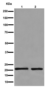 Western blot - Anti-LHFPL5 antibody [EPR16285] - C-terminal (AB192242), expandable thumbnail