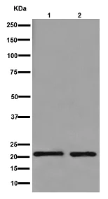 Western blot - Anti-LHFPL5 antibody [EPR16285] - C-terminal (AB192242)