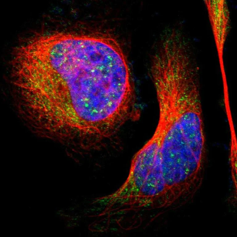 Immunocytochemistry/ Immunofluorescence - Anti-LHPP antibody (AB254788)