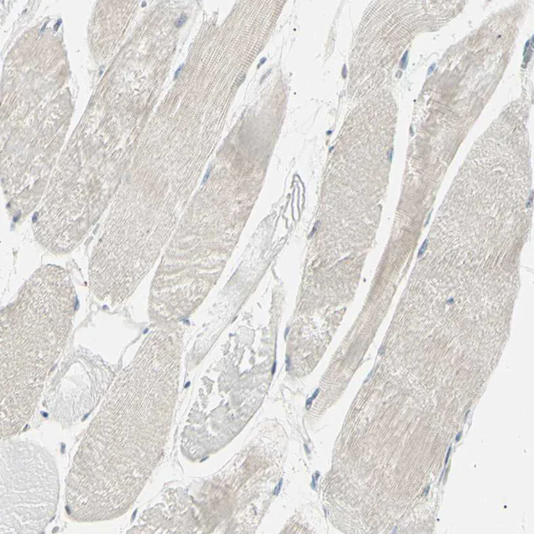 Immunohistochemistry (Formalin/PFA-fixed paraffin-embedded sections) - Anti-LHPP antibody (AB254788)