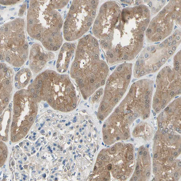 Immunohistochemistry (Formalin/PFA-fixed paraffin-embedded sections) - Anti-LHPP antibody (AB254788)