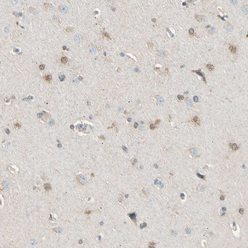 Immunohistochemistry (Formalin/PFA-fixed paraffin-embedded sections) - Anti-LHPP antibody (AB254788)