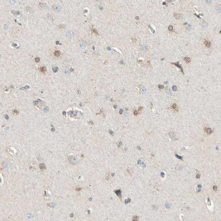 Immunohistochemistry (Formalin/PFA-fixed paraffin-embedded sections) - Anti-LHPP antibody (AB254788)