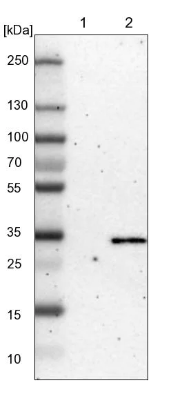Western blot - Anti-LHPP antibody (AB254788)