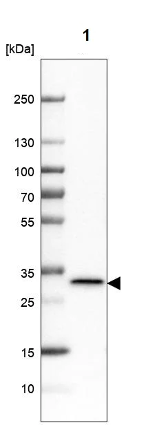 Western blot - Anti-LHPP antibody (AB254788)
