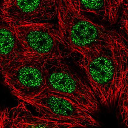 Immunocytochemistry/ Immunofluorescence - Anti-Lhx2/LH2 antibody (AB219983), expandable thumbnail