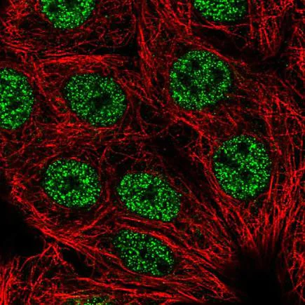 Immunocytochemistry/ Immunofluorescence - Anti-Lhx2/LH2 antibody (AB219983)