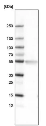 Western blot - Anti-Lhx2/LH2 antibody [CL6137] (AB243030)