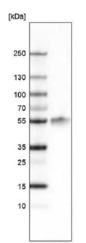 Western blot - Anti-Lhx2/LH2 antibody [CL6137] (AB243030)