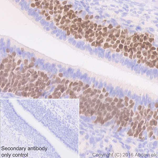 Immunohistochemistry (Formalin/PFA-fixed paraffin-embedded sections) - Anti-Lhx2/LH2 antibody [EPR20449] (AB184337)