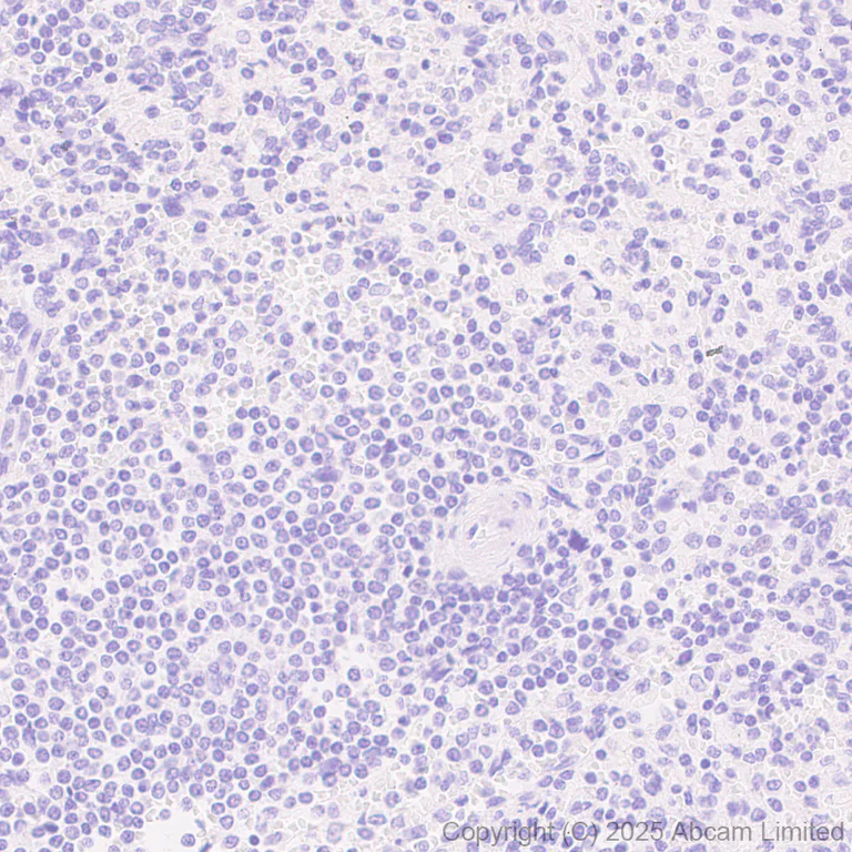 Immunohistochemistry (Formalin/PFA-fixed paraffin-embedded sections) - Anti-LHX3/LIM antibody [EPR29190-234] (AB325931)