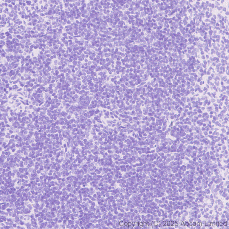 Immunohistochemistry (Formalin/PFA-fixed paraffin-embedded sections) - Anti-LHX3/LIM antibody [EPR29190-234] (AB325931)