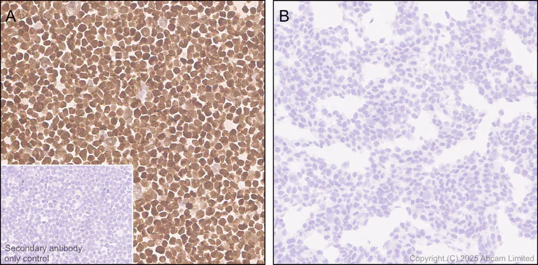 Immunohistochemistry (Formalin/PFA-fixed paraffin-embedded sections) - Anti-LHX3/LIM antibody [EPR29190-234] (AB325931)