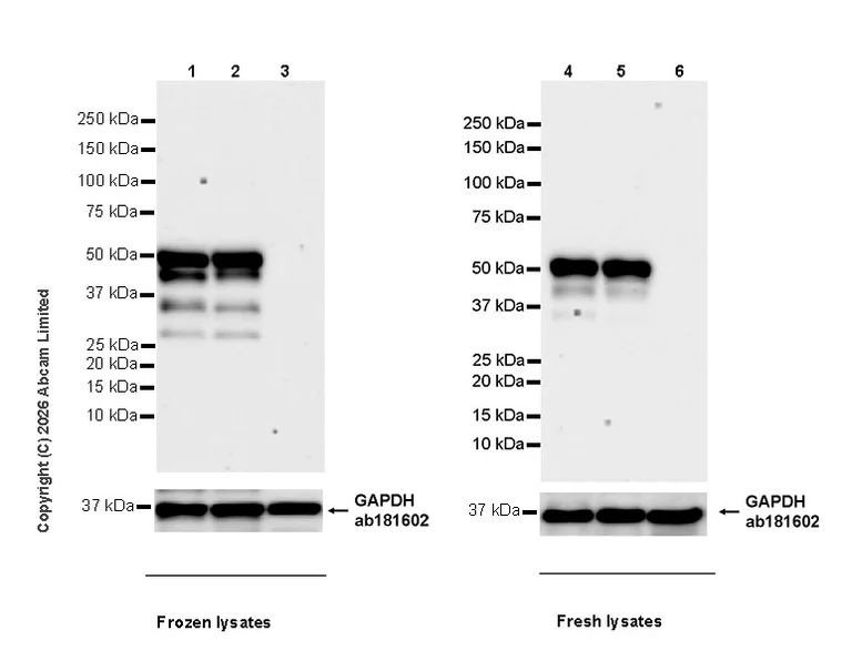 Western blot - Anti-LHX3/LIM antibody [EPR29190-234] (AB325931)