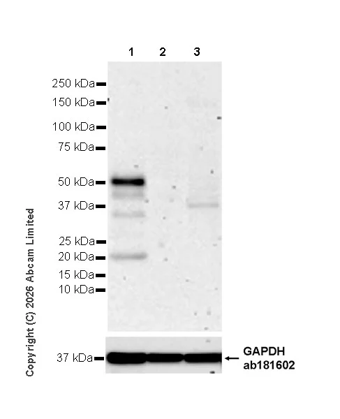 Western blot - Anti-LHX3/LIM antibody [EPR29190-234] (AB325931)