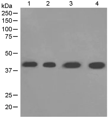 Western blot - Anti-LHX3/LIM antibody [EPR3344(2)] (AB124697)