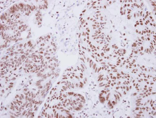 Immunohistochemistry (Formalin/PFA-fixed paraffin-embedded sections) - Anti-Lhx4 antibody (AB227622)