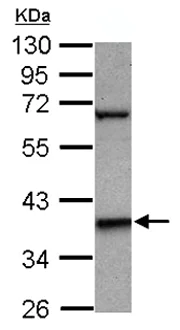 Western blot - Anti-LHX5 antibody (AB127545)