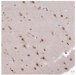 Immunohistochemistry (Formalin/PFA-fixed paraffin-embedded sections) - Anti-LHX5 antibody (AB187975)