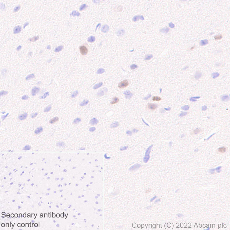 Immunohistochemistry (Formalin/PFA-fixed paraffin-embedded sections) - Anti-LHX6 antibody [EPR26352-101] (AB300441)