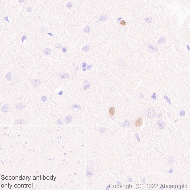 Immunohistochemistry (Formalin/PFA-fixed paraffin-embedded sections) - Anti-LHX6 antibody [EPR26352-101] (AB300441)