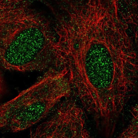 Immunocytochemistry/ Immunofluorescence - Anti-Lhx8 antibody (AB221882), expandable thumbnail