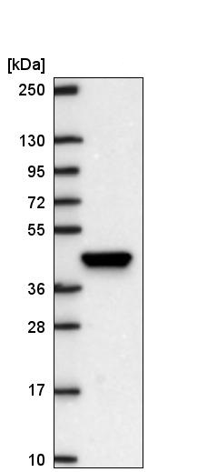 Western blot - Anti-Lhx8 antibody (AB221882), expandable thumbnail
