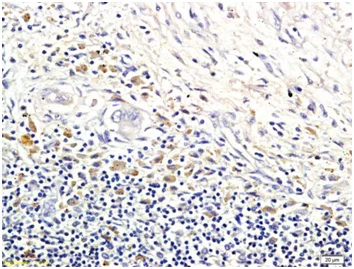 Immunohistochemistry (Formalin/PFA-fixed paraffin-embedded sections) - Anti-LI Cadherin antibody (AB203281)