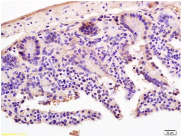 Immunohistochemistry (Formalin/PFA-fixed paraffin-embedded sections) - Anti-LI Cadherin antibody (AB203281)