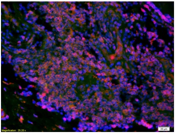 Immunohistochemistry (Formalin/PFA-fixed paraffin-embedded sections) - Anti-LI Cadherin antibody (AB203281)