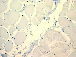 Immunohistochemistry (Formalin/PFA-fixed paraffin-embedded sections) - Anti-LI Cadherin antibody [EPR3996] (AB109190)