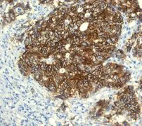 Immunohistochemistry (Formalin/PFA-fixed paraffin-embedded sections) - Anti-LI Cadherin antibody [EPR3996] (AB109190)