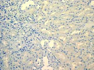 Immunohistochemistry (Formalin/PFA-fixed paraffin-embedded sections) - Anti-LI Cadherin antibody [EPR3996] (AB109190)