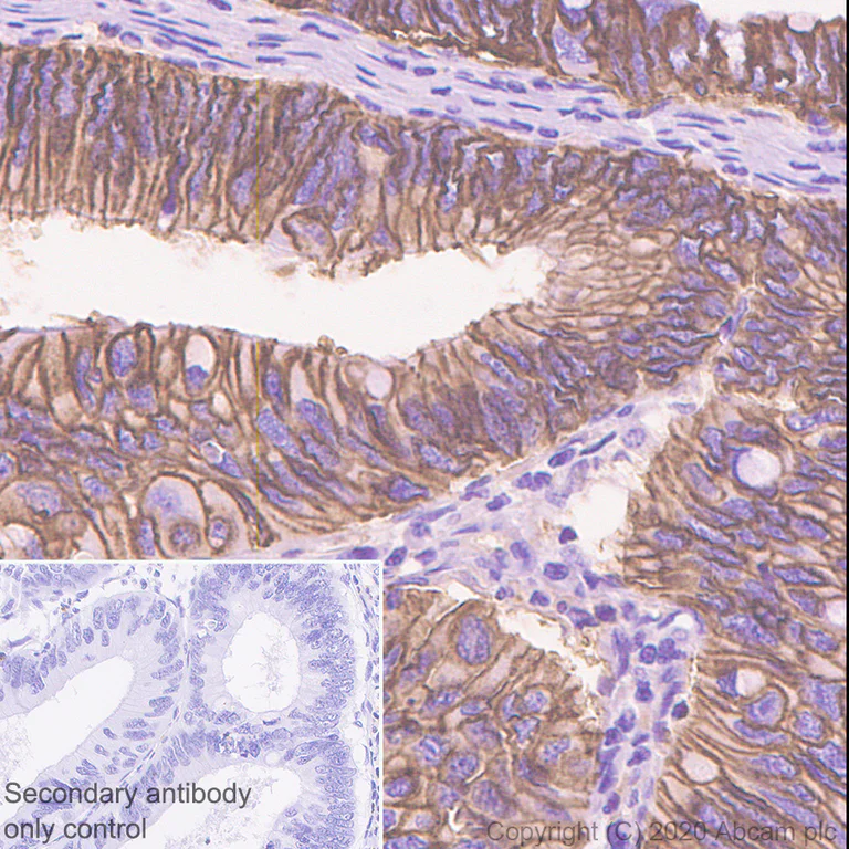 Immunohistochemistry (Formalin/PFA-fixed paraffin-embedded sections) - Anti-LI Cadherin antibody [EPR3996] (AB109190)