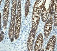 Immunohistochemistry (Formalin/PFA-fixed paraffin-embedded sections) - Anti-LI Cadherin antibody [EPR3996] (AB109190)