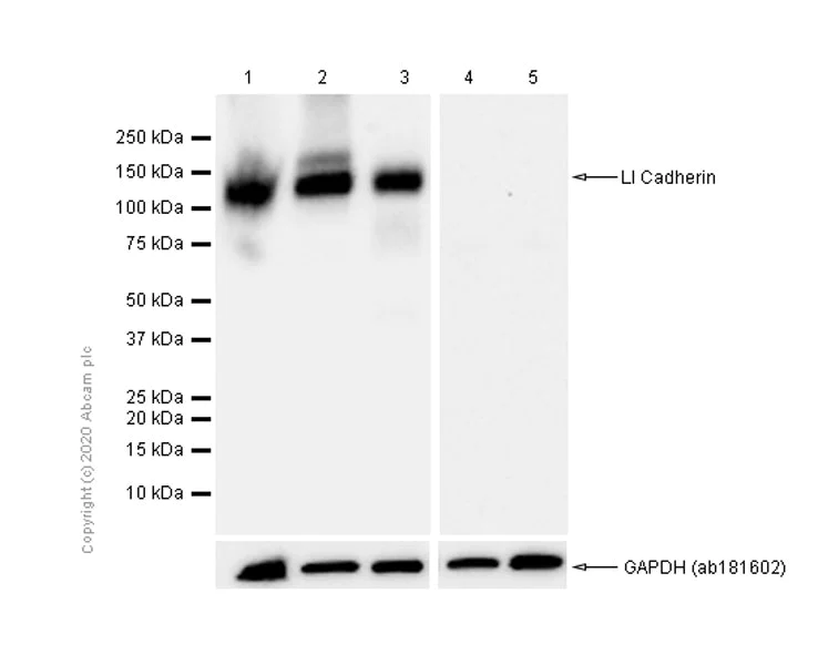 Western blot - Anti-LI Cadherin antibody [EPR3996] (AB109190)