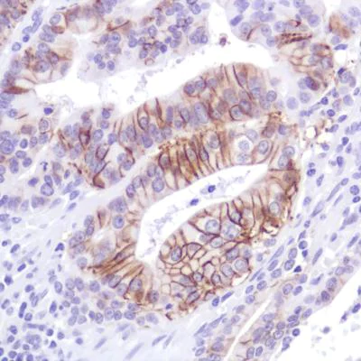 Immunohistochemistry (Formalin/PFA-fixed paraffin-embedded sections) - Anti-LI Cadherin antibody [SP183] - BSA and Azide free (AB240266)