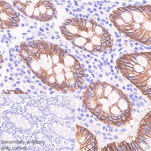 Immunohistochemistry (Formalin/PFA-fixed paraffin-embedded sections) - Anti-LI Cadherin antibody [SP183] - BSA and Azide free (AB240266)